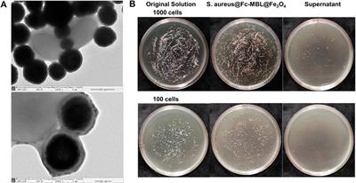 Application of MALDI-TOF MS Profiling Coupled With Functionalized Magnetic Enrichment for Rapid Identification of Pathogens in a Patient With Open Fracture